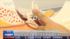 1、颅骨/颞骨非常者：颅骨骨折愈合不良、颞骨正 